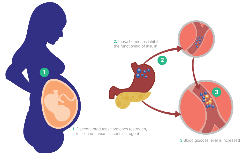 diabetes-a-comprehensive-guide-2021