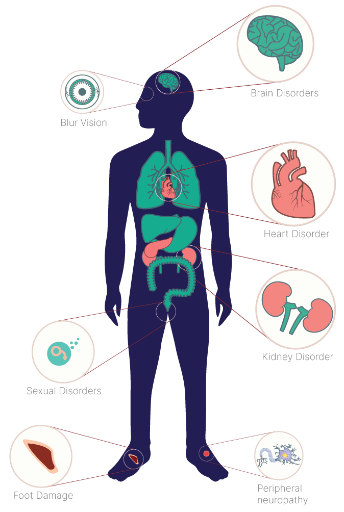 Complications Of Diabetes 9334